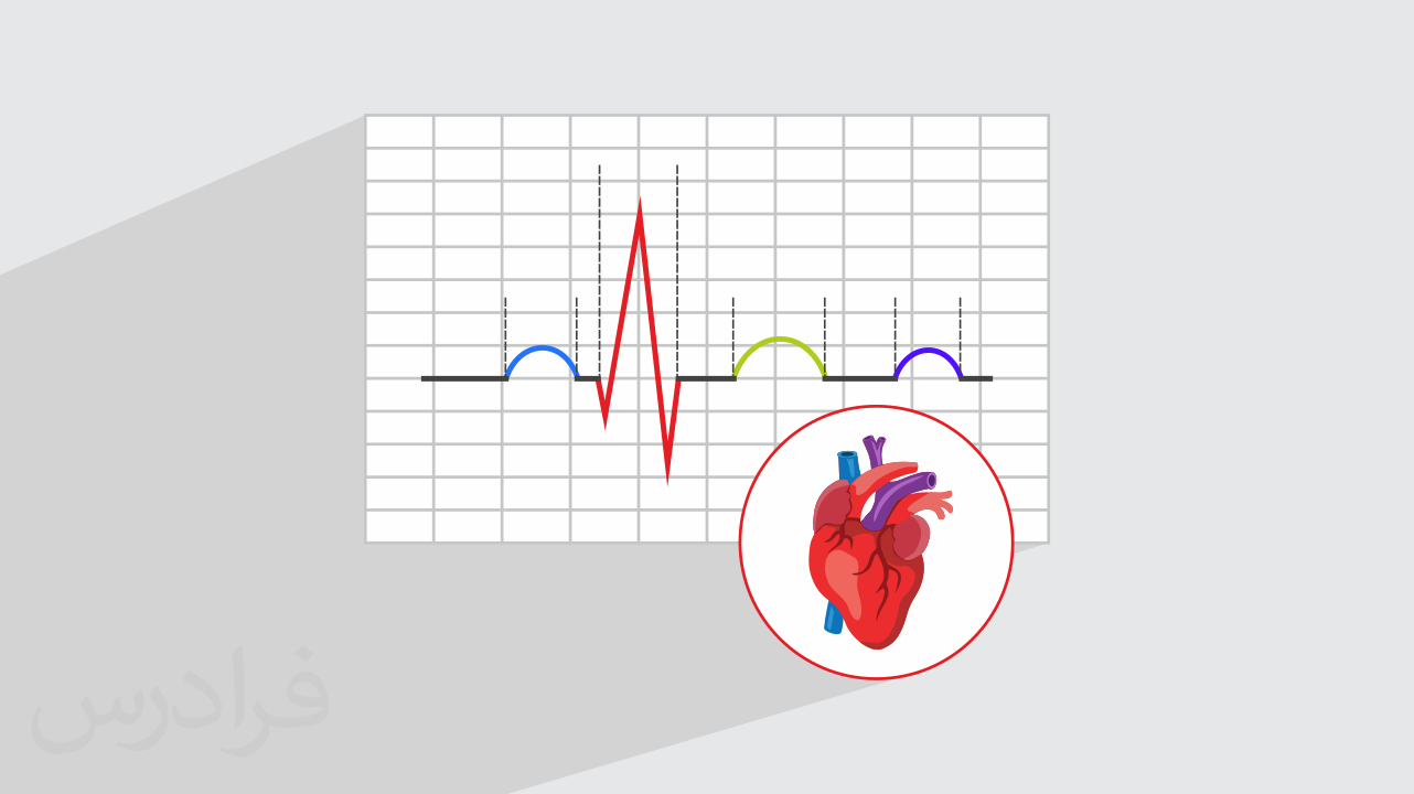 آموزش تشخیص و درمان تاکی‌ آریتمی‌ های با کمپلکس QRS پهن